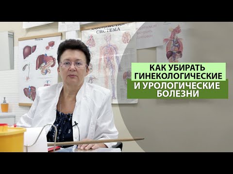 КАК УБИРАТЬ ГИНЕКОЛОГИЧЕСКИЕ И УРОЛОГИЧЕСКИЕ БОЛЕЗНИ