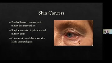 Newton-Wellesley Medical Group Lunch & Learn: Oculoplastics