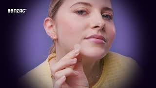 Benzac Power Patches Fast Fix - Mode Of Action Moa