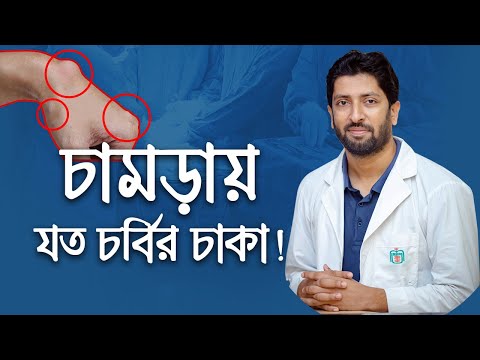 ভিডিও: টোবাগোতে করণীয় শীর্ষস্থানীয় জিনিস