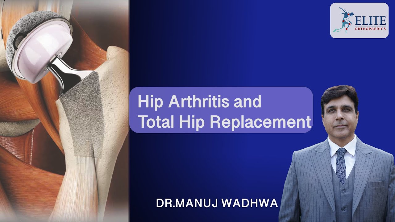 hip-arthritis-and-total-hip-replacement-dr-manuj-wadhwa-elite
