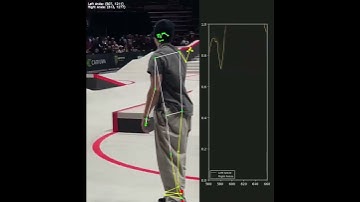 Visualizing Keypoints with Real-Time Tracking
