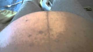 Rumble Rumble In The Tummy