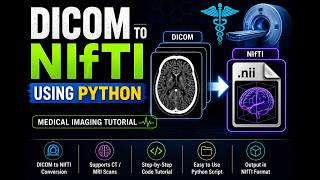 Convert DICOM Files to NIfTI Using Python — Fast & Easy Tutorial