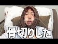 骨切りダウンタイム密着