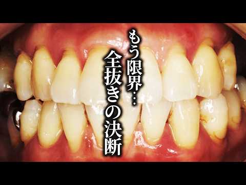 We saved a patient who had been told by his dentist that 