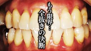 We saved a patient who had been told by his dentist that 