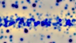 Medical Virus Bacteria Microscopic view Animation Background video, No Copyright screenshot 4