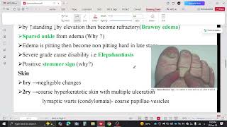 Vascular surgery By FLASH - lymphatic system (lymphedema)