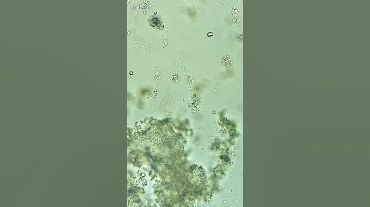 Chobani Yogurt Under Microscope (Probiotics) - 天天要聞
