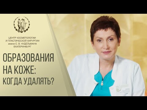 👌 Безопасное удаление родинок в Екатеринбурге. Удалить родинку Екатеринбург. Клиника Нудельман. 12+