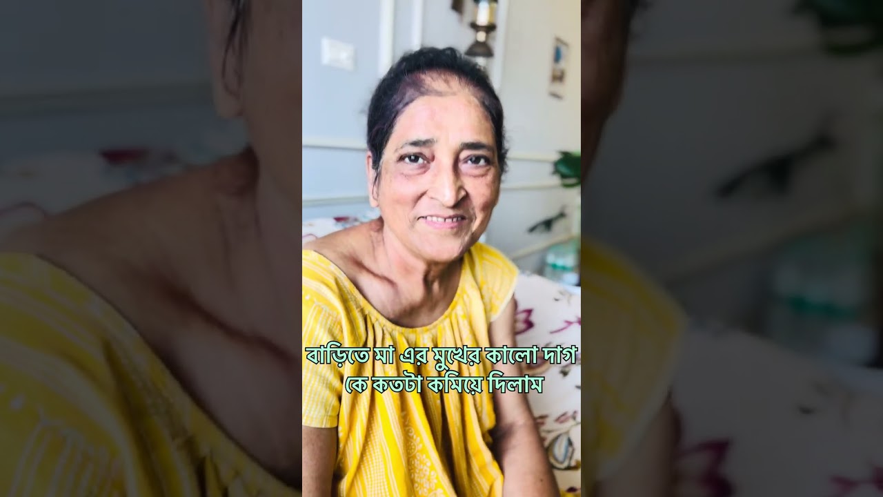 মা সবার যত্ন করে মায়েদের ও যত্ন করতে হয় 