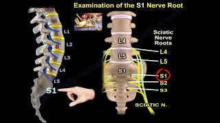 Examination Of S1 Nerve Root - Everything You Need To Know - Dr. Nabil Ebraheim