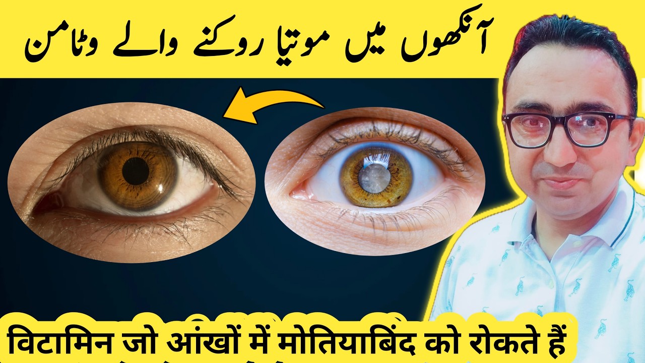 5 Best Vitamins to Prevent Eye Diseases!