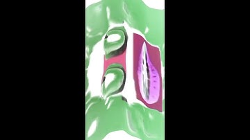 KlaskyKlaskyKlaskyKlasky (Windows 8 Csupo Feels Dizzy)