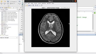 Digital Watermarking Using Discrete Wavelet Transform for Medical images in  MATLAB