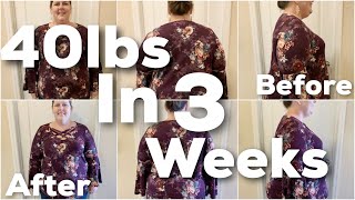 Losing 40 Pounds In 3 Weeks  My Bariatric Surgery Story and Gastric Sleeve Results