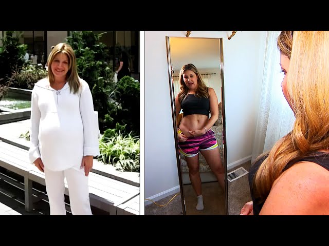 Woman Shows Off Bikini Body After Getting ‘Mommy Makeover’ class=
