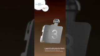 discovery® smart sl Bracket – sichere Haftung dank laserstrukturierter Basis
