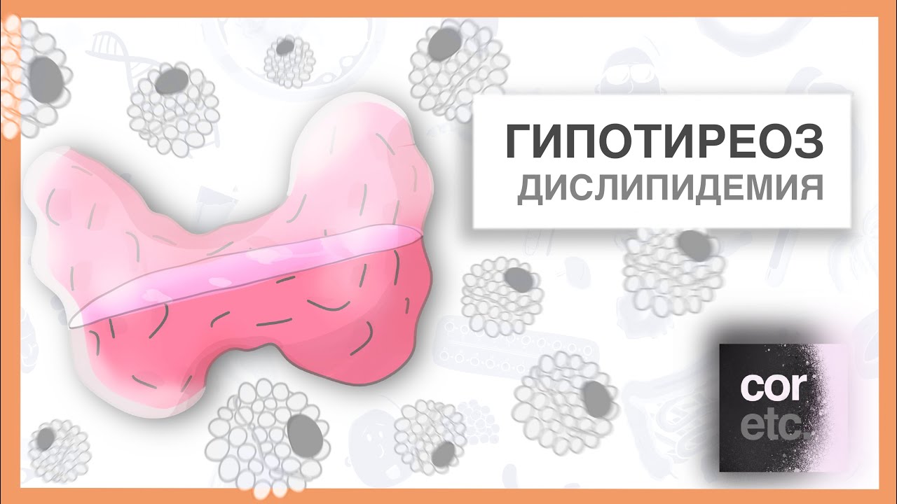 Дислипидемия при гипотиреозе. Лечить или нет? - YouTube