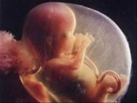 Video: Kedy Colorado legalizovalo potraty?