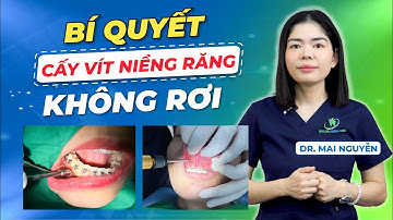 BÍ QUYẾT GIÚP BẠN GIỮ MINIVIS CHẮC CHẮN SUỐT QUÁ TRÌNH NIỀNG RĂNG