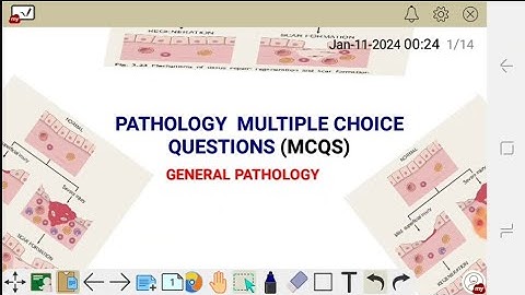 GENERAL PATHOLOGY MCQS