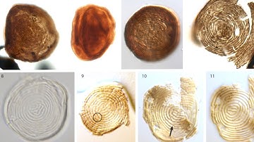 What Has Kept This Creature Alive During All of Earth’s Extinction Events?