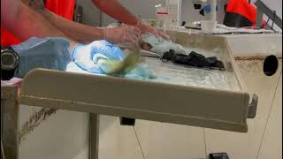 20210709 Steinvick Biopsy2