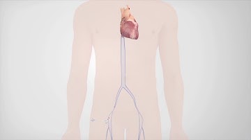 Radiofrequency Catheter Ablation