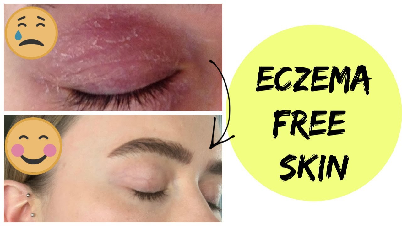 WHAT I EAT FOR CLEAR, ECZEMA FREE SKIN IN A DAY YouTube