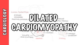 Dilated Cardiomyopathy  causes, symptoms, pathophysiology and treatment