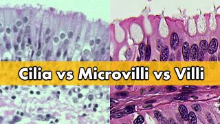 Cilia vs Microvilli vs Villi