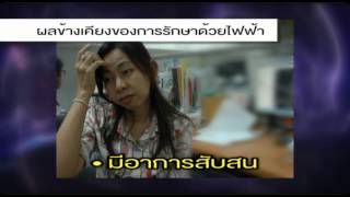 ความรู้เกี่ยวกับการรักษาด้วยไฟฟ้า (Electro Convulsive Therapy; ECT)