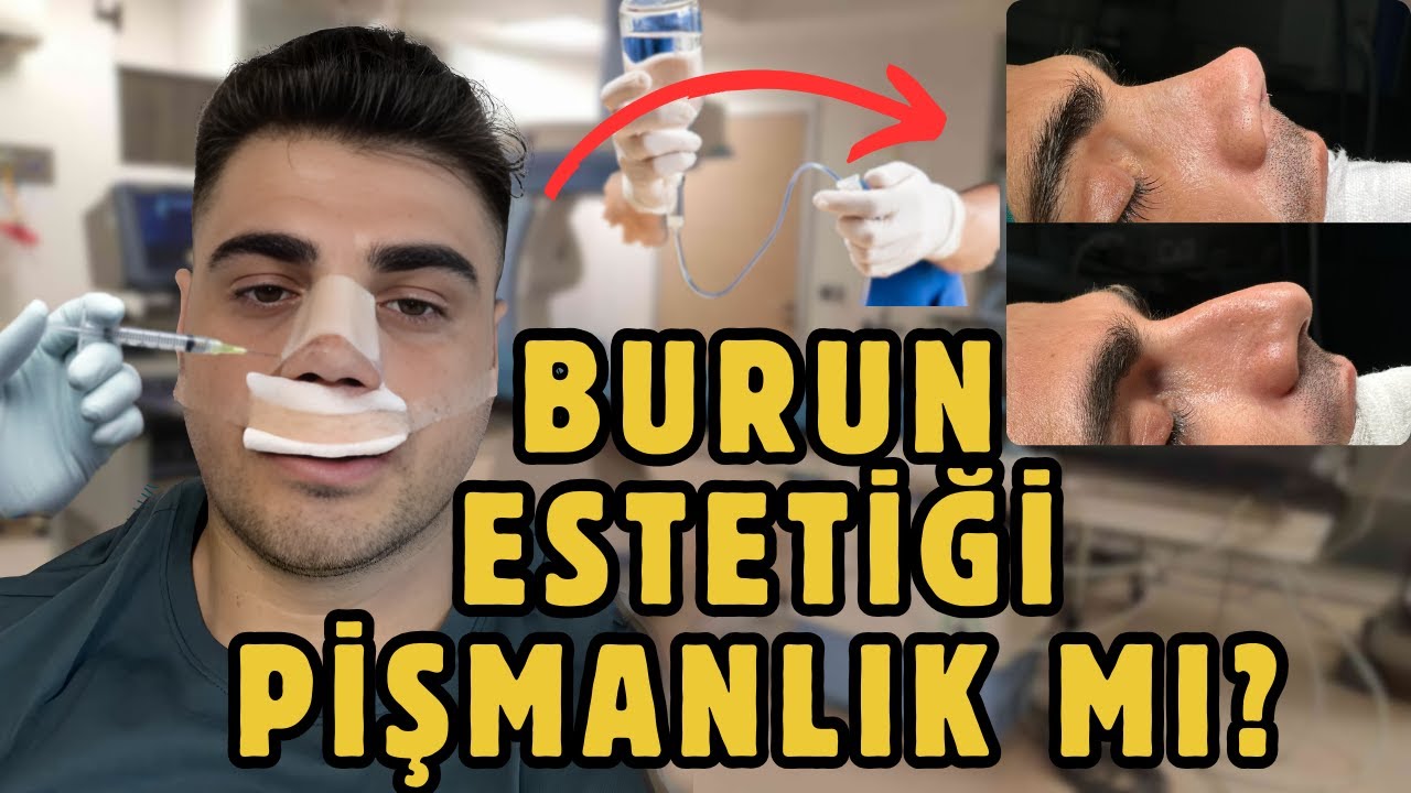 BURUN AMELİYATI OLDUM! | Tüm Süreç / 1 HAFTALIK VLOG