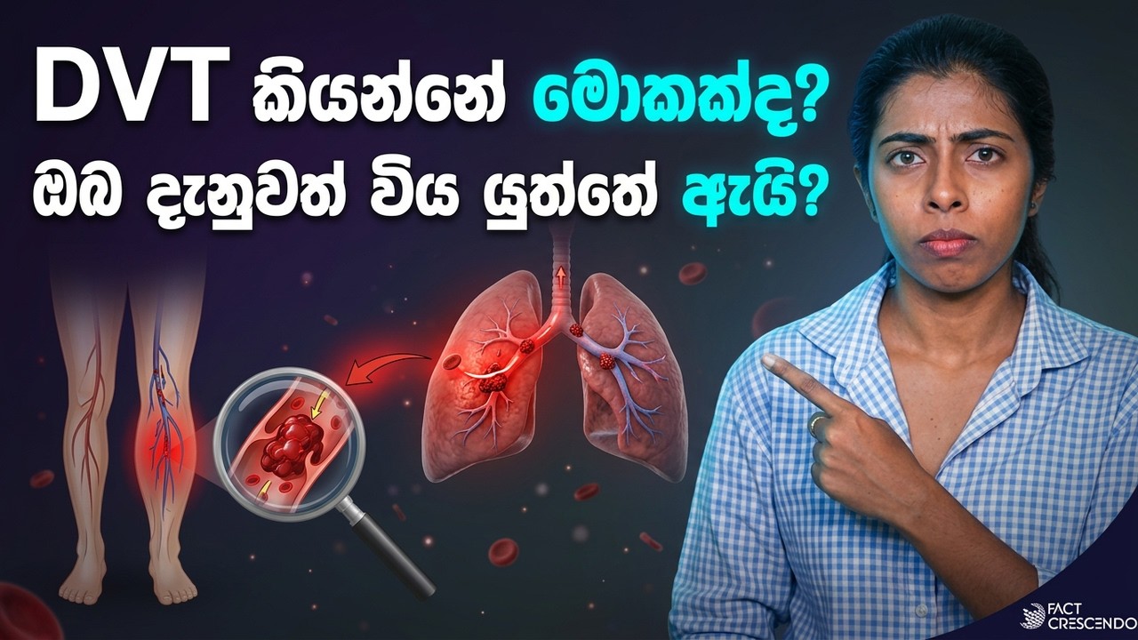 DVT කියන්නේ මොකක්ද? ඔබ දැනුවත් විය යුත්තේ ඇයි?  | What Is DVT ? (Deep Vein Thrombosis)