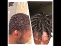 From Starter Locs To Dreadlocks (9 month Journey)