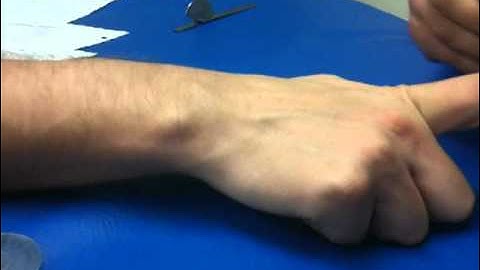 Goniometric technique for MCP joint flexion and extension digits 2-5
