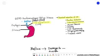 Barrett Esophagus Full HD