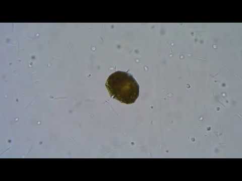 Панцирный жгутиконосец - динофлагеллят (Dinoflagellata).