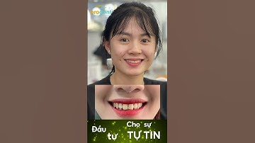 Bọc răng sứ Orodent | Khách hàng Review #shorts