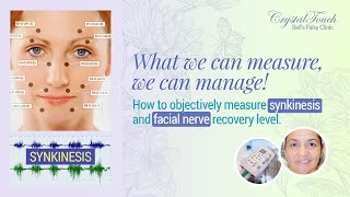 How to Objectively Measure Facial Nerve Recovery Level and Synkinesis after Bell’s Palsy