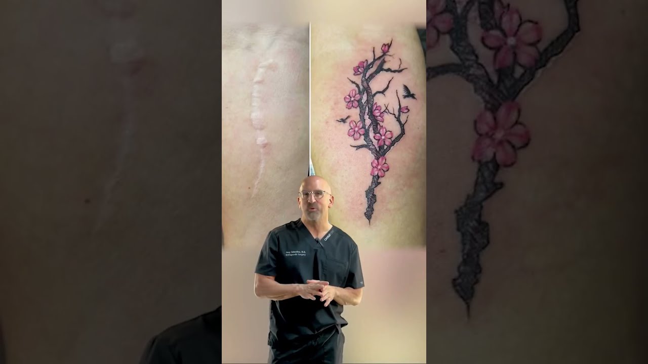 Tattoo Or Scar Shorts Scars