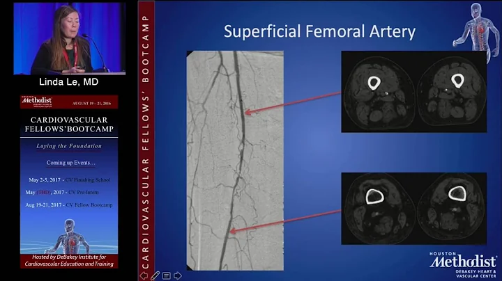Lower Extremity Anatomy (Linda Le, MD) Saturday, A...