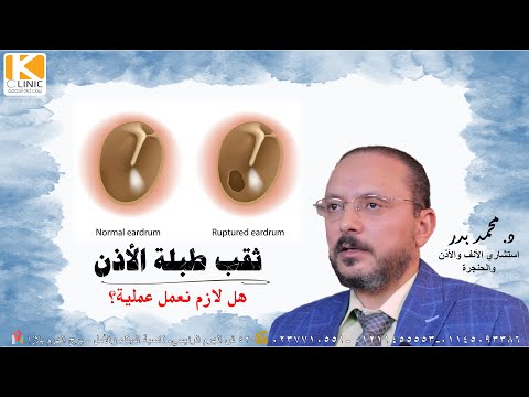 فيديو: هل تعمل أبواق الأذن؟