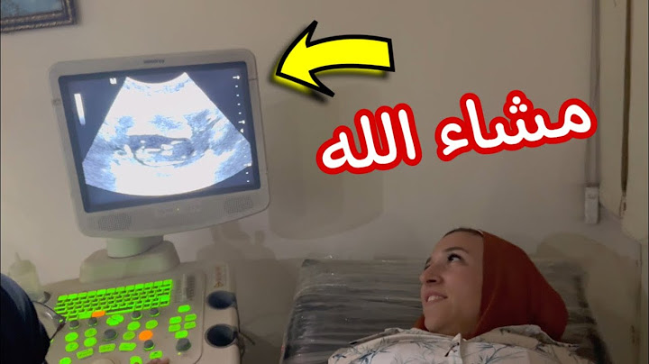 شفنا البيبى لأول مره - فرحة هند و صالح