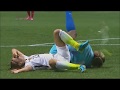 Alex Morgan Injuries