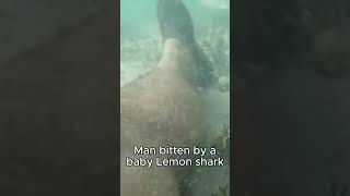 Man bitten my baby lemon shark