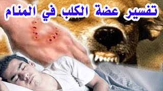 تفسير حلم عضة الكلب في المنام  في اليد اليمنى واليد اليسرى والفخذ