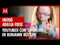 Murió Adalia Rose, youtuber con el 'síndrome de Benjamin Button', a los 15 años